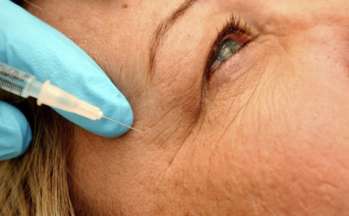 Филъри от &bdquo;сивия сектор&ldquo;: лекари предупреждават за риск от ослепяване и инсулт