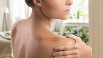 Учени от Харвард разкриха механизъм за заздравяване на кожата без белези