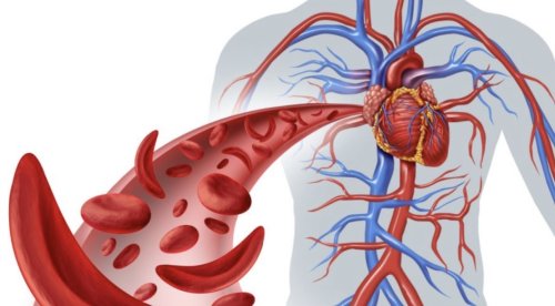 Анемия след 40? Първо изключете рак на дебелото черво
