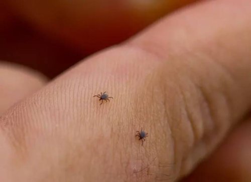 Зачестяват случаите на ухапвания от кърлежи в София: Лекари развенчават опасни митове за премахването им (ВИДЕО)